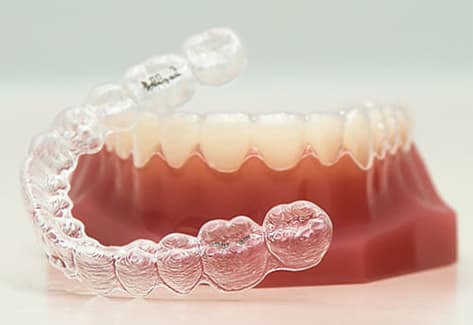 What is Invisalign | Jubilee Dental Centre | Summerland, BC